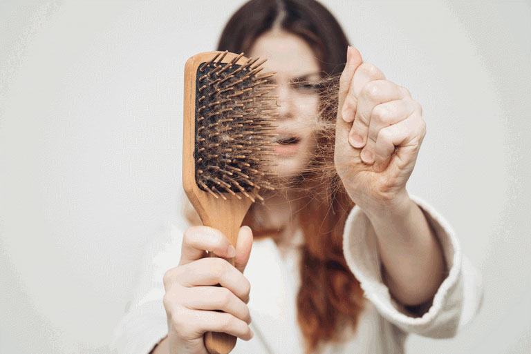3 Ways to prevent Hair Loss